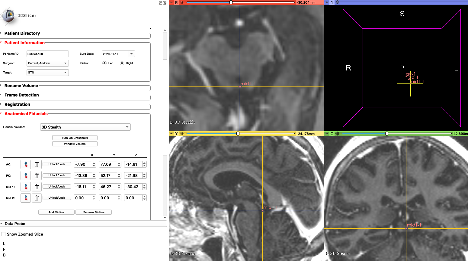 ../_images/Mid1Markup.png