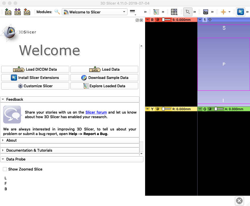_images/Slicer-Welcome.png