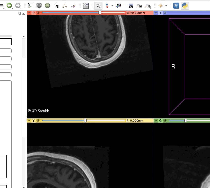 ../_images/coregConfirm1.gif