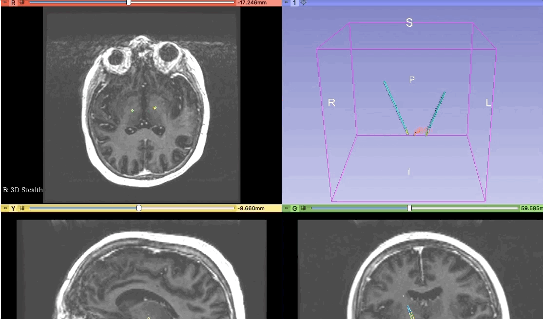 ../_images/plan3DView.gif