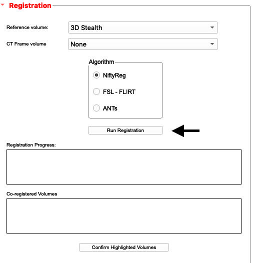 ../_images/registration.png
