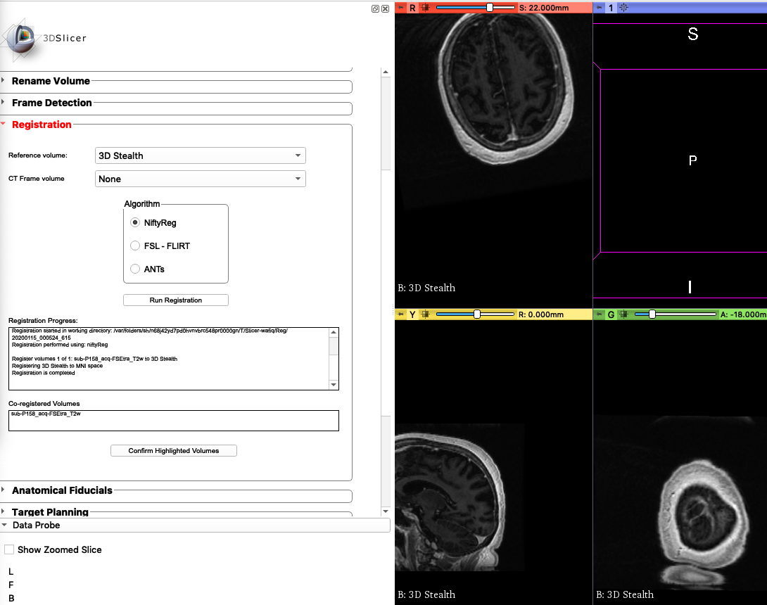 ../_images/registrationComplete.png