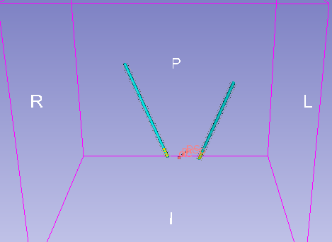 ../_images/rightPlanConfirmed.png
