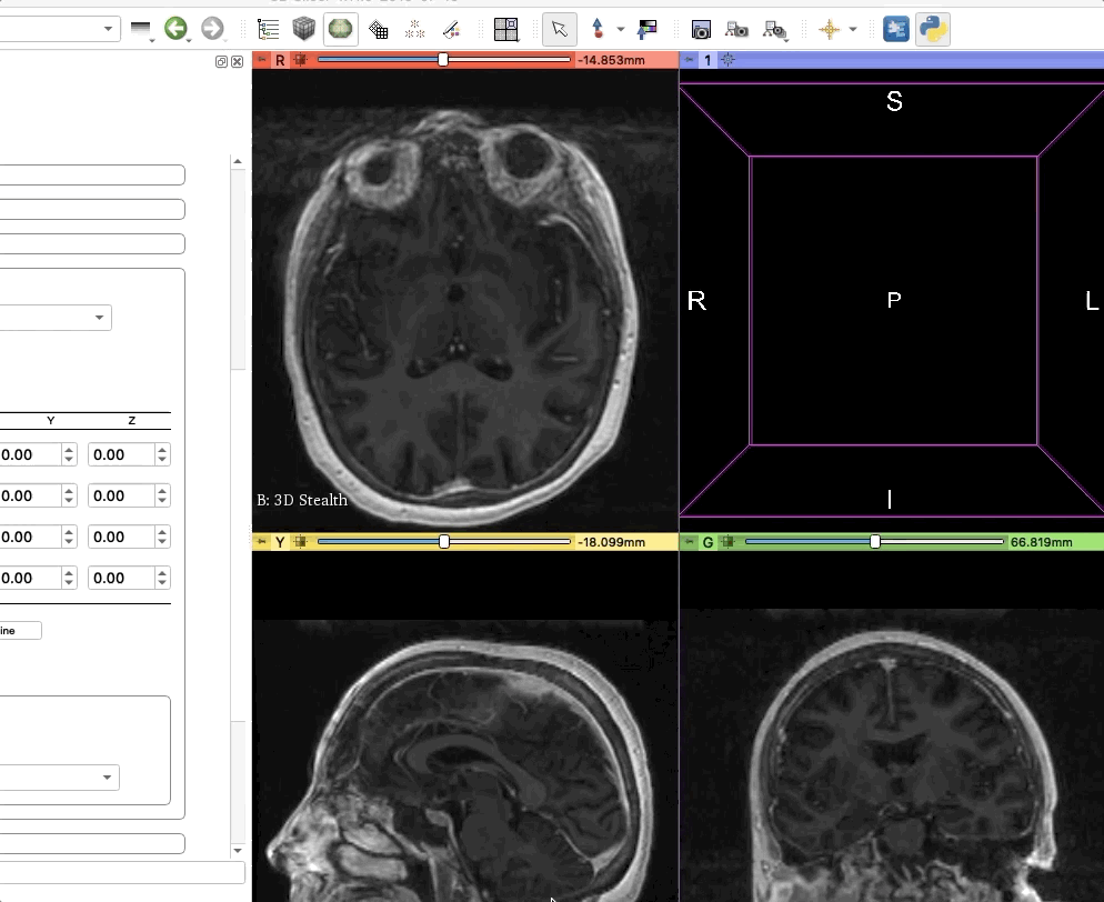 ../_images/windowTool.gif