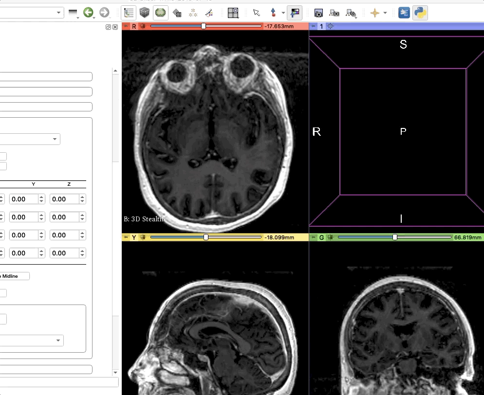../_images/windowTool2.gif